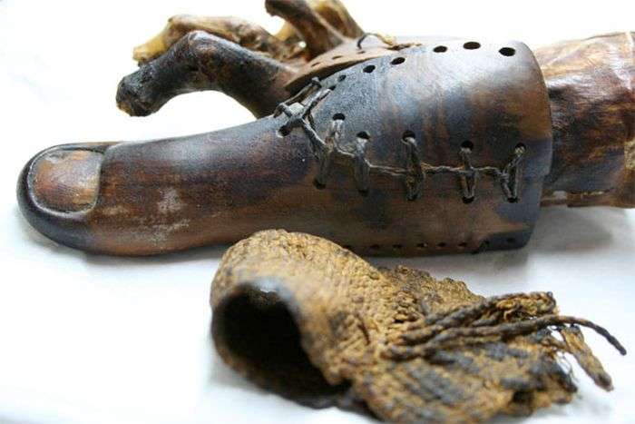 Середньовічне протезування кінцівок людини (21 фото)