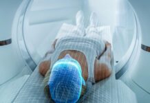 Чому повторне ПЕТ-сканування, націлене на PSMA, виявляє прихований рак простати